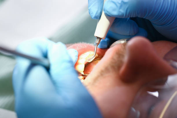 Best Orthodontic Emergency Dentist in Four Corners, TX