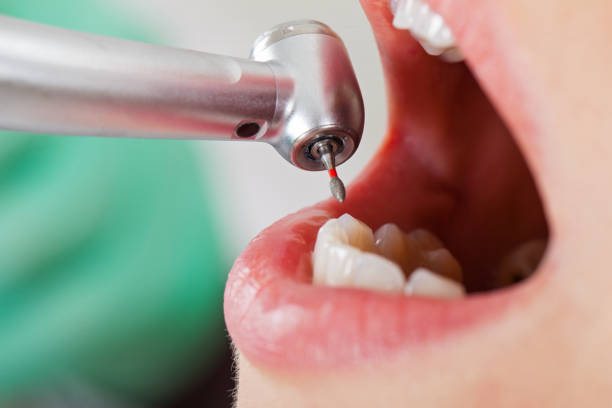 Best Orthodontic Emergency Dentist in Four Corners, TX